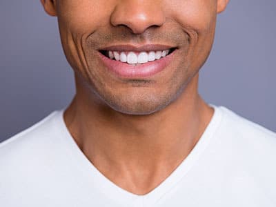 Does Having Straight Teeth Matter?
