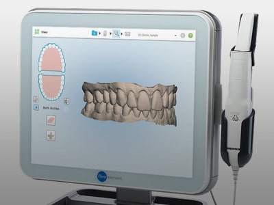 Digital Impressions Davoody & Hablinski Orthodontics in Houston, TX