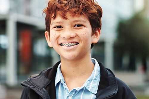 Braces for Kids Davoody & Hablinski Orthodontics in Houston, TX