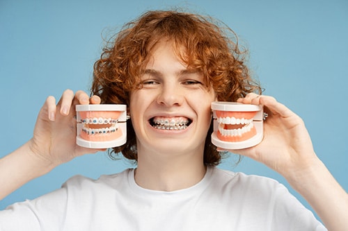 Types of Braces Davoody & Hablinski Orthodontics in Houston, TX