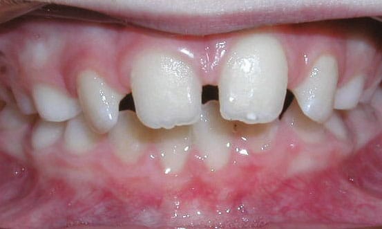 Spacing Davoody & Hablinski Orthodontics in Houston, TX