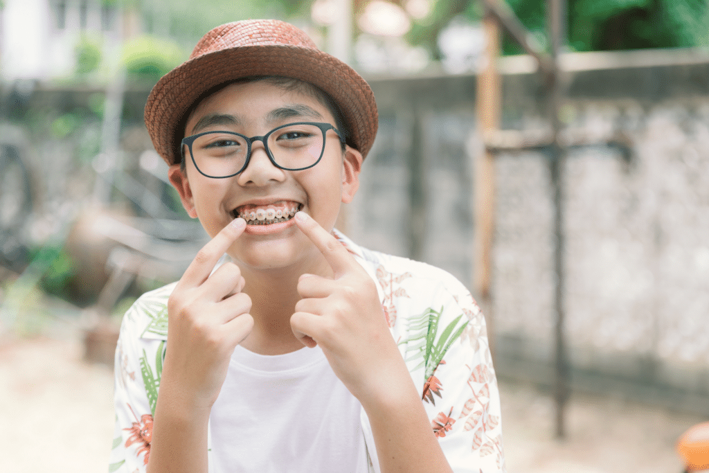 Smiling boy with glasses pointing to his braces outdoors
